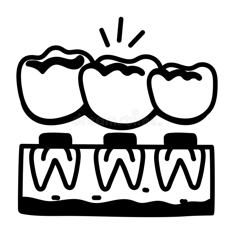 Best Metal Dental Bridge in Indirapuram